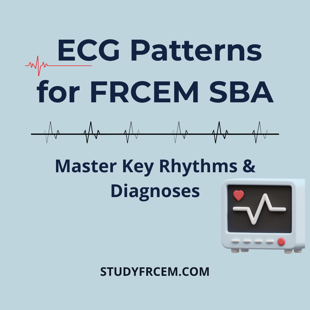 Essential ECG Patterns for FRCEM SBA – Master Key Rhythms & Diagnoses
